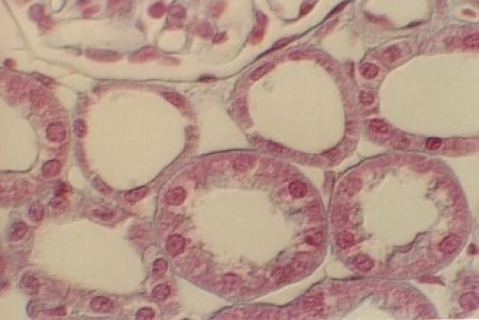 renal cells
