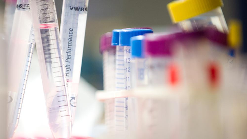 A collection of test tubes containing coloured liquid