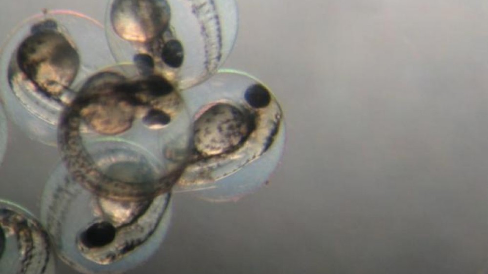 Cells under a microscope
