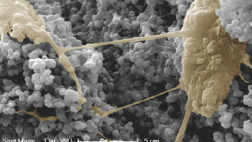 Cells at the surface of constructs imaged using scanned electron microscopy