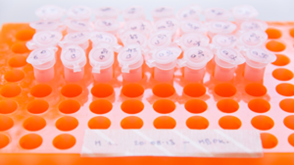 Centrifuge tubes in a orange rack