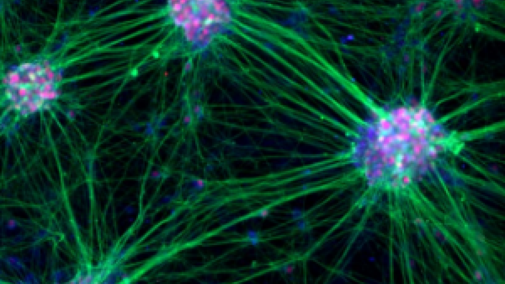 Characterisation of human nerve cells