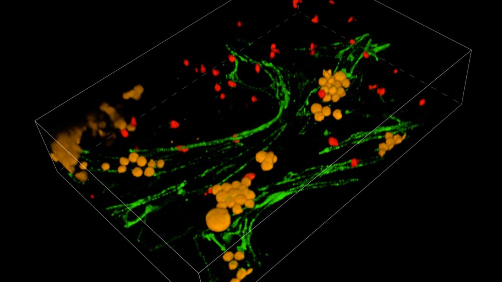 The 3Rs Prize winning leukaemia-on-chip device contains six different cell types and recreates the human bone marrow niche.