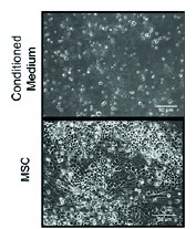  Leukaemia cells grown long-term in vitro by culturing with MSCs