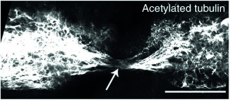 Axons are able to bridge the lesion in the zebrafish  larval model enabling regeneration of the spinal cord.