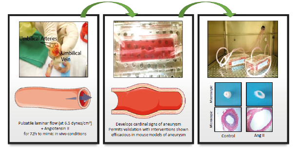 Development and characterisation of a novel human ex vivo model of aneurysm