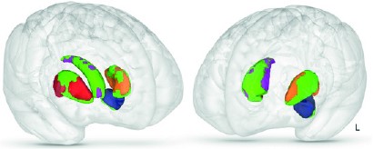 Particular parts of your brain (marked in  green) relate to increased nausea severity