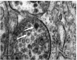 Japanese encephalitis viral particles (marked with arrows) are able to infect cells forming the blood brain barrier.