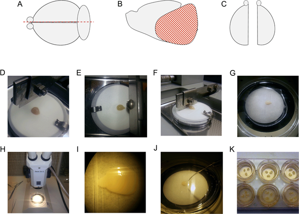 Methodology for preparing brain slice cultures with a range of images from A to K