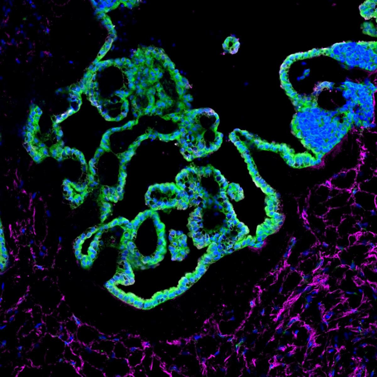 ​​​​​​​Section of a choroid plexus organoid, stained for epithelial cells (green) and stromal cells (magenta).