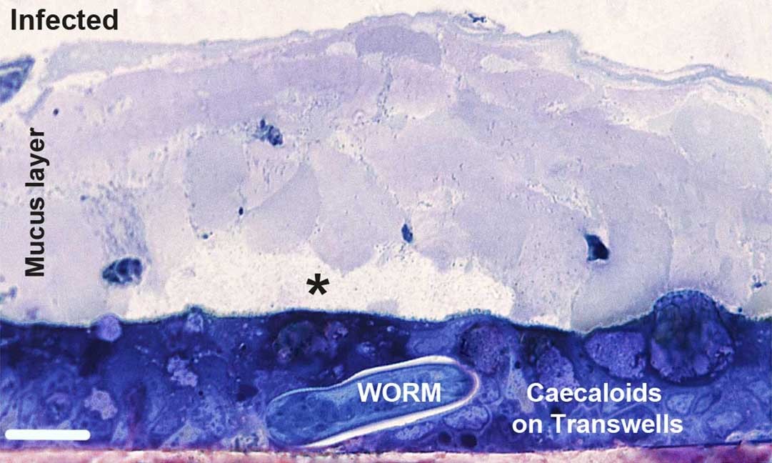 Whipworm L1 larvae invade caecal epithelium by degrading the overlaying mucus layer