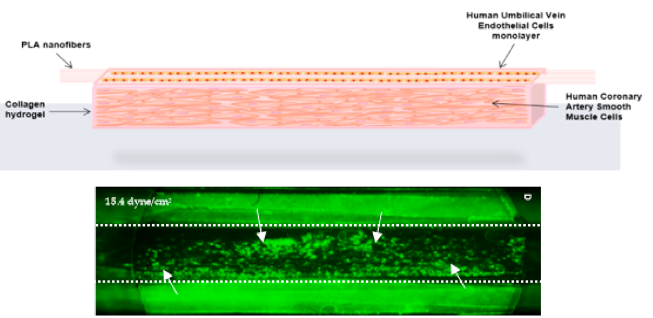 Platelets clotting in a tissue engineered human vein under high blood flow stress.