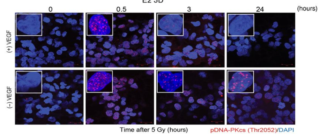 Immunofluorescent imaging of glioblastoma cells grown in 3D conditions