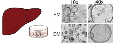 Brightfield microscope images of liver organoids in expansion medium and differentiation media.