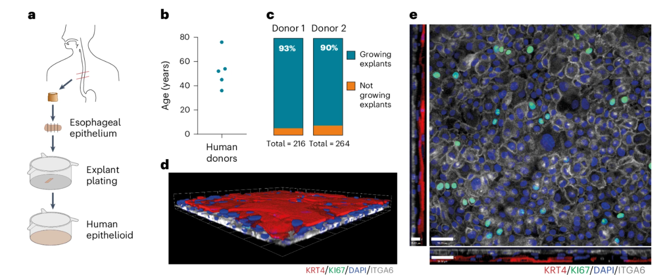 Figure showing the establishment and characterisation of human oesophageal epithelial explants.   (a) Schematic diagram illustrating the experimental workflow: oesophageal epithelium is isolated from human donors, plated, and forms a human epithelioid.   (b) Dot plot showing the ages of human donors, ranging from young to elderly.   (c) Bar chart showing high explant growth efficiency from two donors (93% and 90%).   (d) 3D confocal image of cultured epithelial explants stained for KRT4 (red), KRT6 (green), DAPI (blue), and ITGA6 (white), showing stratified epithelial structure.   (e) Confocal image showing dense epithelial cell layers with labelled markers (KRT4/KRT6/DAPI/ITGA6), indicating a well-formed epithelium. Scale bars are shown.