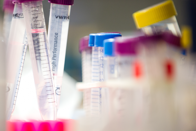 A collection of test tubes containing coloured liquid