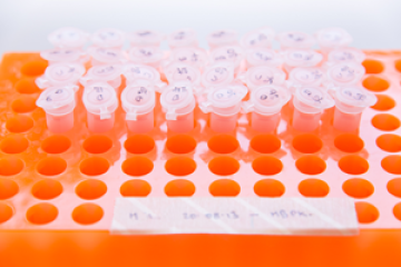 Centrifuge tubes in a orange rack